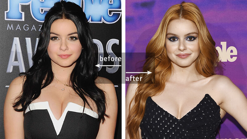 Ariel Winter Before-and-After Plastic Surgery