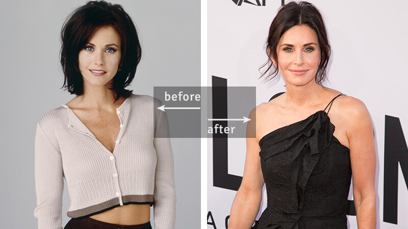 Courteney Cox Before-and-After Plastic Surgery