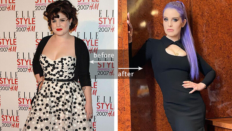 Kelly Osbourne Weight Loss - Before & After